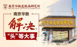 小儿斑秃是什么原因引起的“南京治脱发斑秃医院”