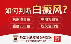 白癜风患者必看：端午出行防晒指南+24小时在线挂号服务