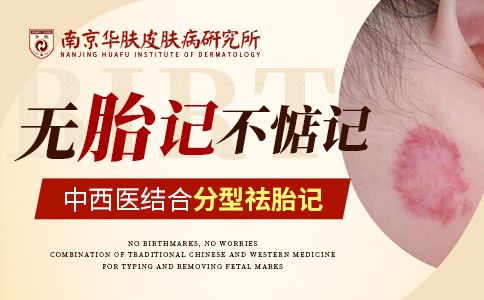 胎记会越长越大吗“南京去胎记好的医院排名”