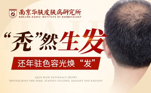 斑秃早期症状“南京治疗斑秃的好医院”